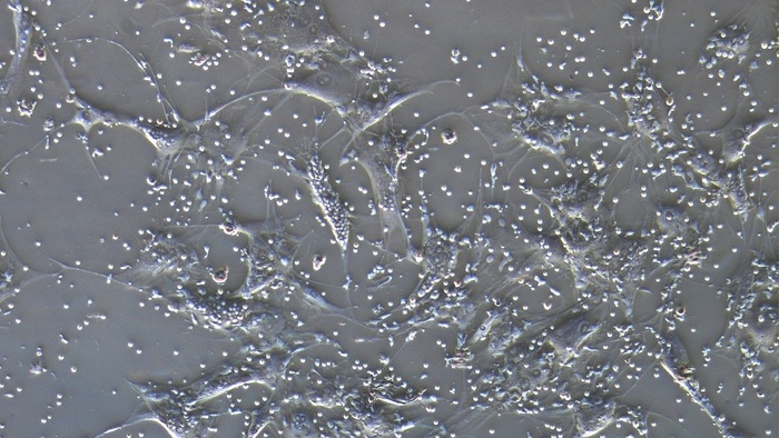 trzydniowa kohodowla limfocytów Treg (małe komórki) oraz MSC (duże komórki); w centrum widoczna jest komórka MSC, którą pokrywają limfocyty Treg